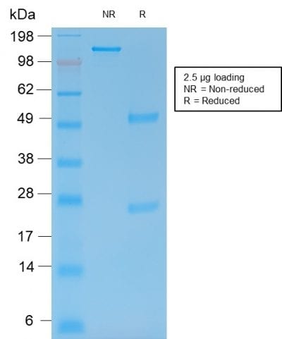 MMP9 Recombinant Monoclonal Mouse Antibody (rMMP9/1769)