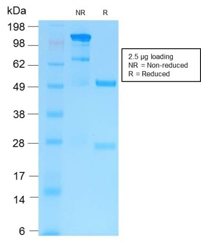 MMP9 Recombinant Monoclonal Rabbit Antibody (MMP9/2025R)
