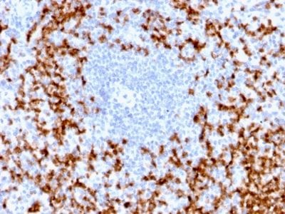 MMP9 Recombinant Monoclonal Rabbit Antibody (MMP9/2025R)
