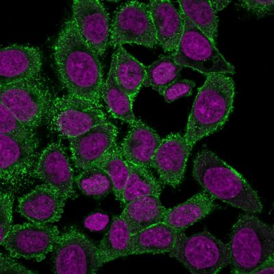 Moesin Monoclonal Mouse Antibody (MSN/492)