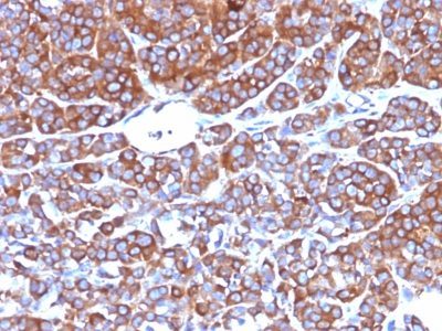 Moesin Monoclonal Mouse Antibody (MSN/492)