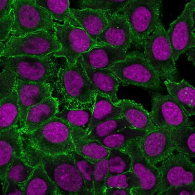 Moesin Monoclonal Mouse Antibody (MSN/493)