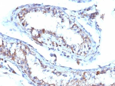 Moesin Monoclonal Mouse Antibody (MSN/493)