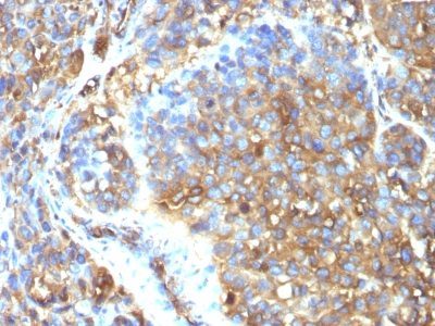Moesin Monoclonal Mouse Antibody (MSN/493)
