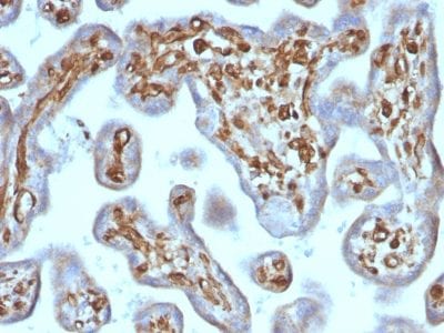 Moesin Recombinant Monoclonal Mouse Antibody (rMSN/492)