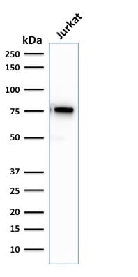 Moesin Recombinant Monoclonal Mouse Antibody (rMSN/492)