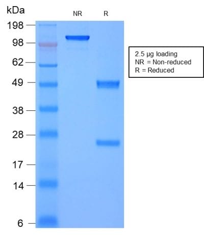 Moesin Recombinant Monoclonal Mouse Antibody (rMSN/492)