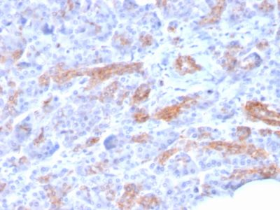 MRP3 Monoclonal Mouse Antibody (ABCC3/2971)
