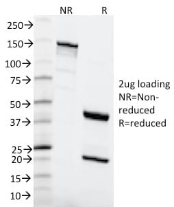 MSH6 Monoclonal Mouse Antibody (MSH6/2111)