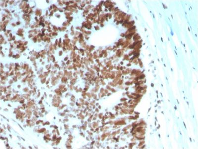 MSH6 Monoclonal Mouse Antibody (MSH6/2927)