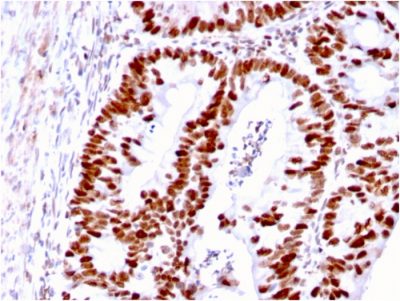 MSH6 Monoclonal Mouse Antibody (MSH6/3085)