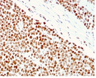 MSH6 Monoclonal Mouse Antibody (MSH6/3086)