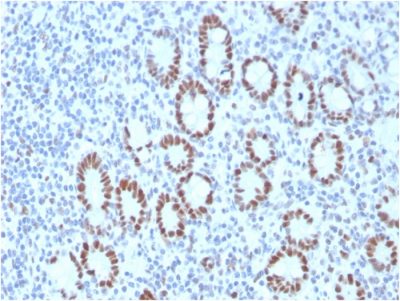 MSH6 Monoclonal Mouse Antibody (MSH6/3089)