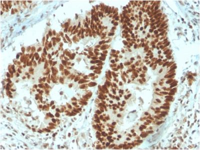 MSH6 Monoclonal Mouse Antibody (MSH6/3091)