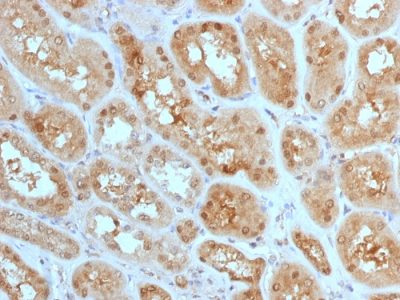 MTAP Monoclonal Mouse Antibody (MTAP/1813)