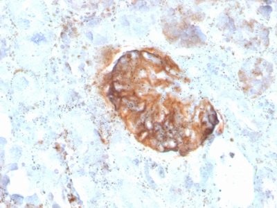MTAP Recombinant Monoclonal Mouse Antibody (rMTAP/1813)