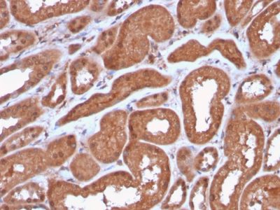 MTAP Recombinant Monoclonal Rabbit Antibody (MTAP/3137R)