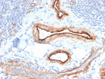 MTF1 Monoclonal Mouse Antibody (MTF1/2649)