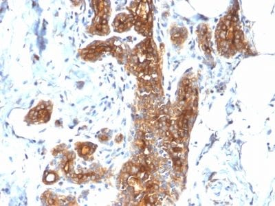 Mucin 1 / EMA / Episialin / CD227 Recombinant Monoclonal Rabbit Antibody (MUC1/2278R)