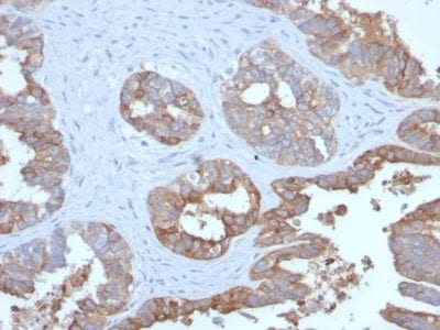 Mucin 1 / EMA / Episialin / CD227 Recombinant Monoclonal Rabbit Antibody (MUC1/2729R)