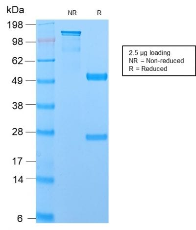 Mucin 1 / EMA / Episialin / CD227 Recombinant Monoclonal Rabbit Antibody (MUC1/2729R)