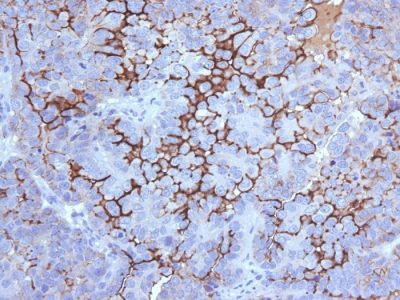 Mucin 16 / MUC16 / CA125 Monoclonal Mouse Antibody (500000000000)