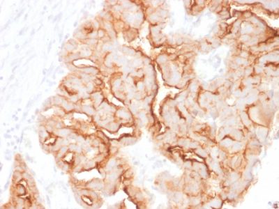 Mucin 16 / MUC16 / CA125 Monoclonal Mouse Antibody (MUC16/1860)