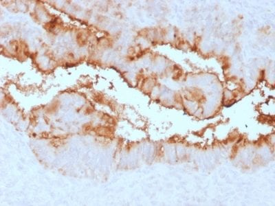 Mucin 16 / MUC16 / CA125 Recombinant Monoclonal Rabbit Antibody (OCA125/2349R)