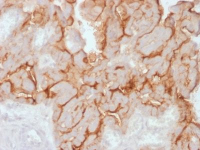 Mucin 16 / MUC16 / CA125 Recombinant Monoclonal Rabbit Antibody (OCA125/2349R)
