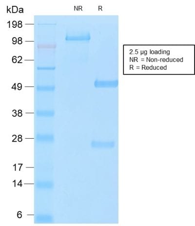 Mucin 16 / MUC16 / CA125 Recombinant Monoclonal Rabbit Antibody (OCA125/2349R)