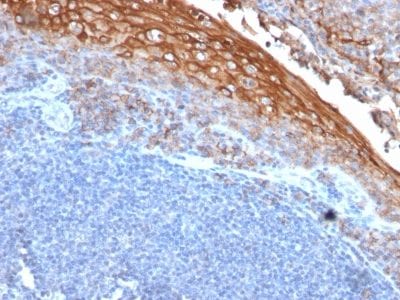 Mucin 18 / MUC18 / CD146 / MCAM Recombinant Monoclonal Mouse Antibody (rMUC18/1130)