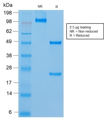Mucin 18 / MUC18 / CD146 / MCAM Recombinant Monoclonal Mouse Antibody (rMUC18/1130)