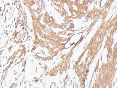 Muscle Specific Actin Monoclonal Mouse Antibody (HHF35 + MSA/953)