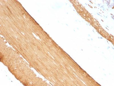 Muscle Specific Actin Monoclonal Mouse Antibody (HHF35 + MSA/953)