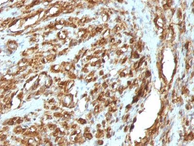 Muscle Specific Actin Monoclonal Mouse Antibody (HHF35 + MSA/953)