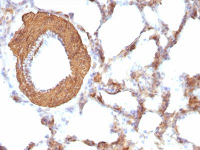 Muscle Specific Actin Monoclonal Mouse Antibody (HHF35 + MSA/953)