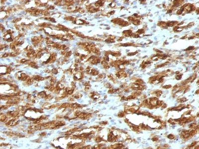 Muscle Specific Actin Monoclonal Mouse Antibody (HHF35)