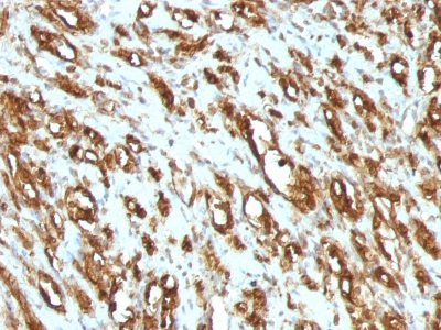 Muscle Specific Actin Monoclonal Mouse Antibody (MSA/953)