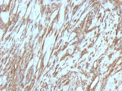 Muscle Specific Actin Monoclonal Mouse Antibody (MSA/953)