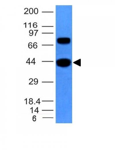 Muscle Specific Actin Monoclonal Mouse Antibody (MSA/953)