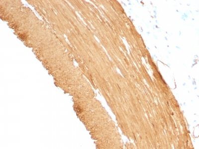 Muscle Specific Actin Monoclonal Mouse Antibody (MSA/953)