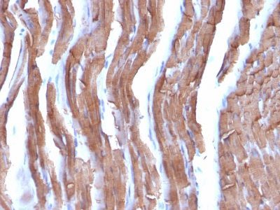 Muscle Specific Actin Monoclonal Mouse Antibody (MSA/953)