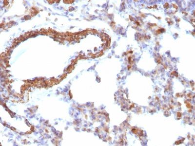 Muscle Specific Actin Monoclonal Mouse Antibody (MSA/953)
