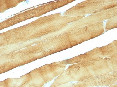 Muscle Specific Actin Monoclonal Mouse Antibody (MSA/953)