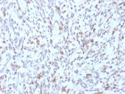 MyoD1 Recombinant Monoclonal Mouse Antibody (rMYD712)