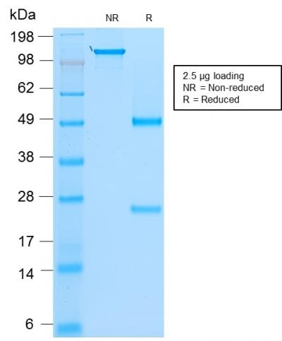 MyoD1 Recombinant Monoclonal Mouse Antibody (rMYD712)