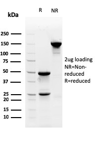 Myofibroblast Marker Monoclonal Mouse Antibody (PR 2D3)