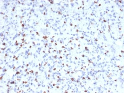 Myogenin Monoclonal Mouse Antibody (MYOG/2660)
