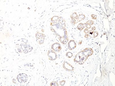 Myosin, Smooth Muscle Heavy Chain Monoclonal Mouse Antibody (ID8)