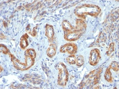 Myosin, Smooth Muscle Heavy Chain Monoclonal Mouse Antibody (ID8)